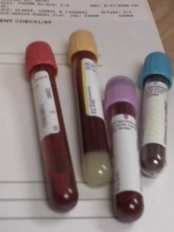 Test Tubes of Blood Work